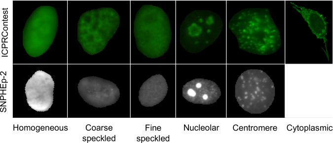 Classification of Human Epithelial Type 2 Cell Indirect