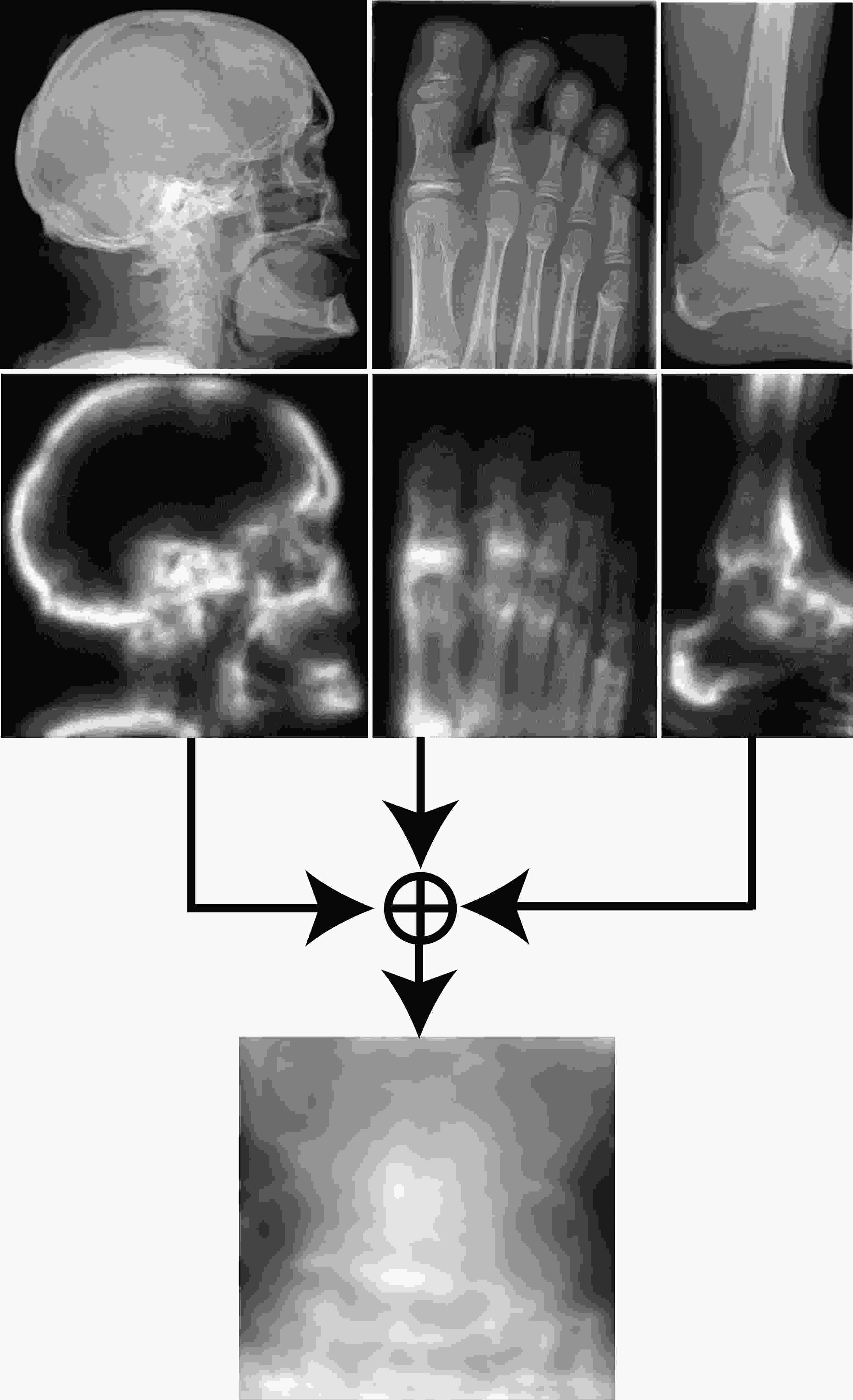 Medical Image Classification via SVM using LBP Features from Saliency ...