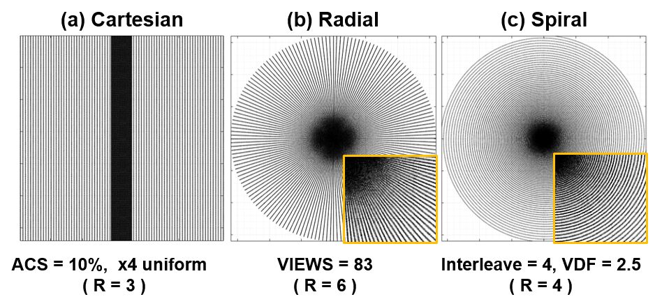 k-Space Deep Learning for Accelerated MRI | DeepAI
