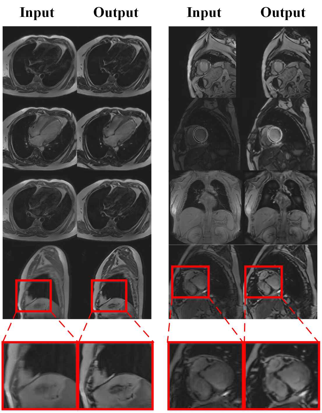 CMR motion artifact correction using generative adversarial nets DeepAI