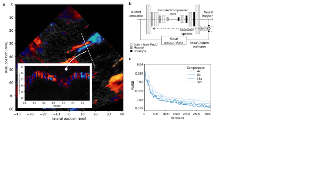 Deep learning in ultrasound imaging | DeepAI