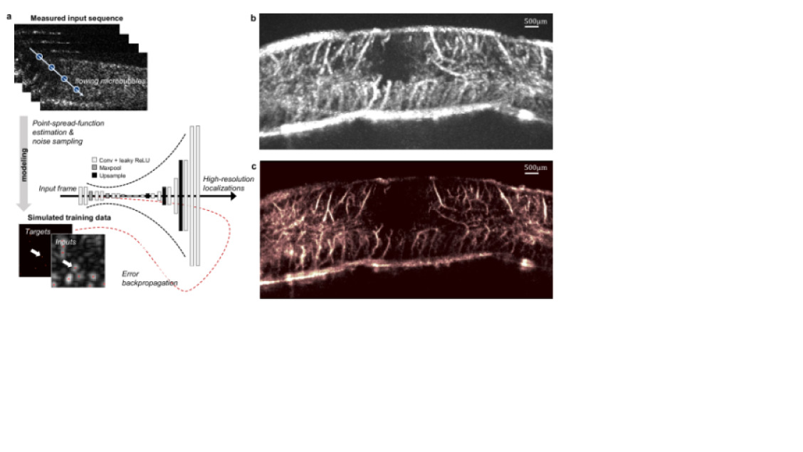 Deep learning in ultrasound imaging | DeepAI