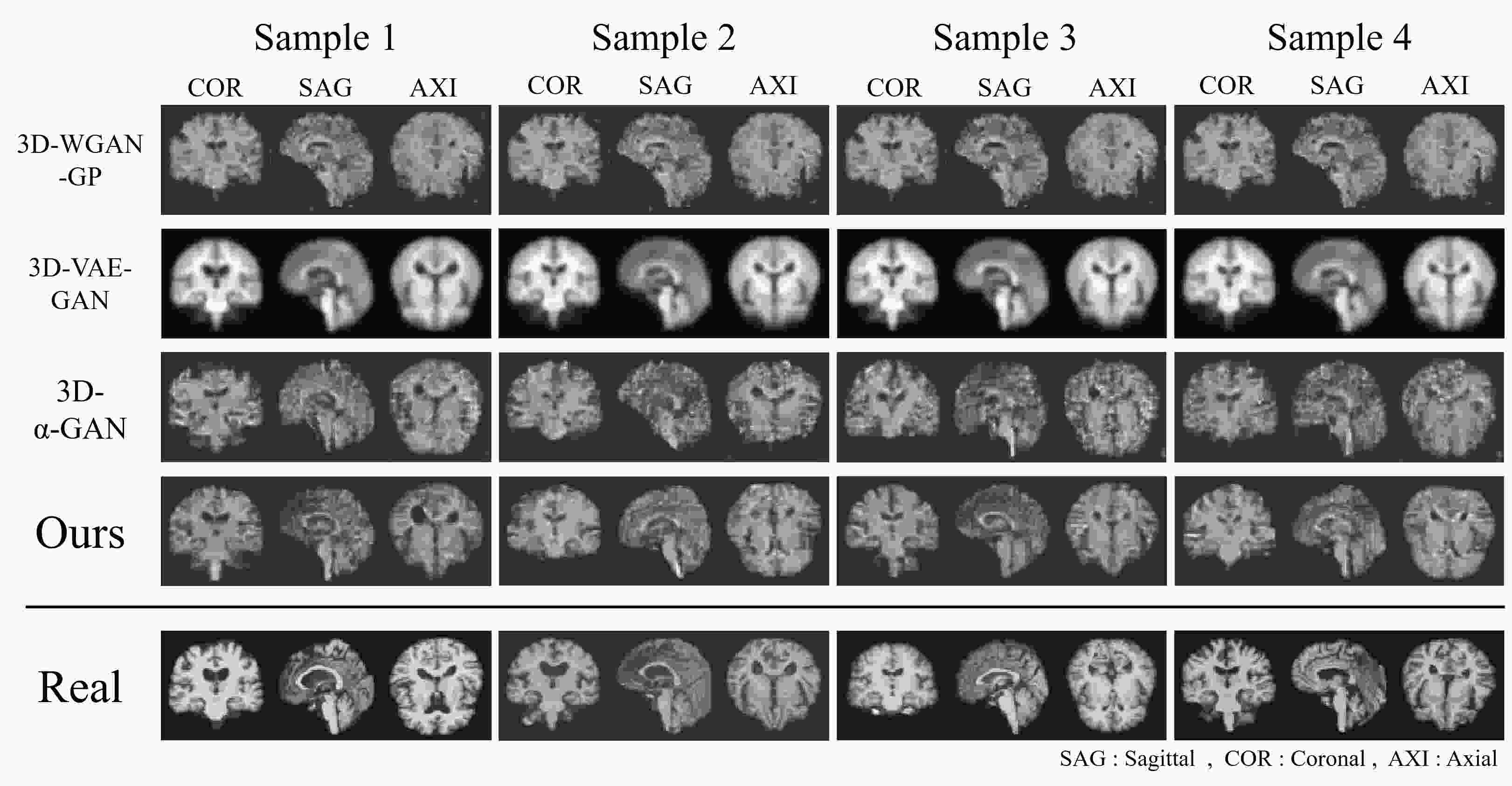Generation of 3D Brain MRI Using Auto-Encoding Generative Adversarial ...