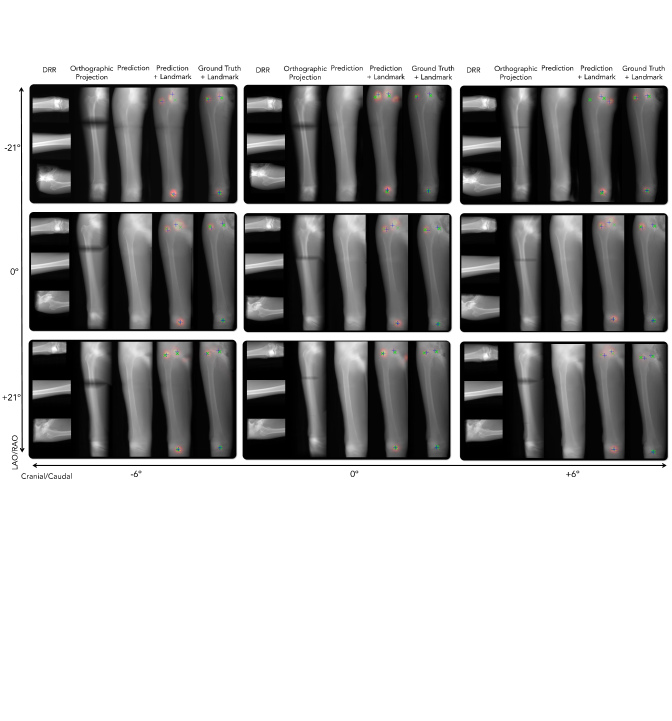 From Perspective Xray Imaging to ParallaxRobust Orthographic
