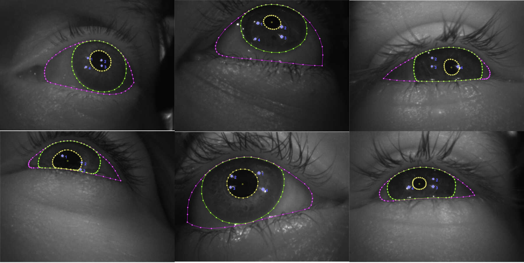 MagicEyes A Large Scale Eye Gaze Estimation Dataset for Mixed Reality