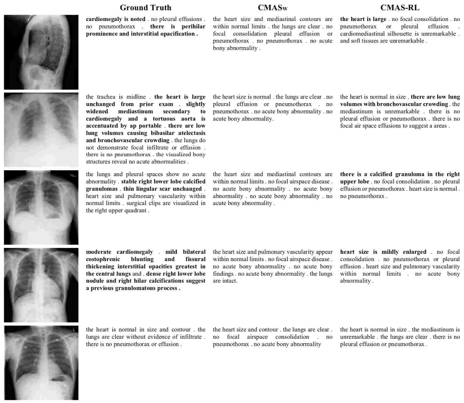 Show, Describe and Conclude On Exploiting the Structure Information of Chest XRay Reports DeepAI