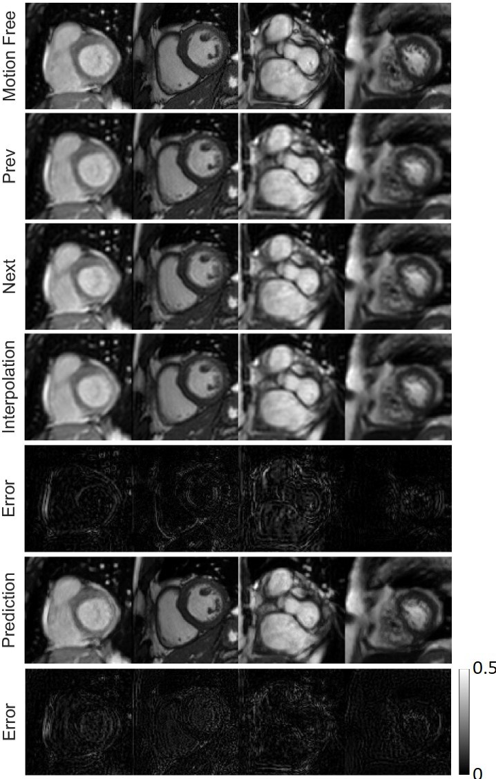 Cine Cardiac MRI Motion Artifact Reduction Using a Recurrent NeuralN