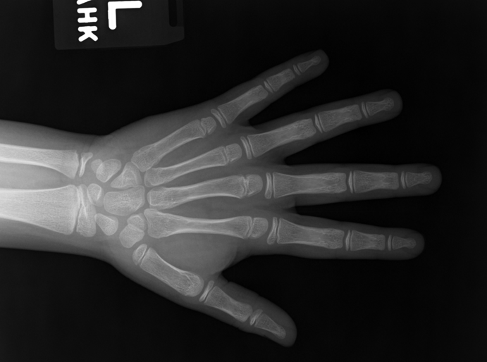 Xray Images for Bone and Soft Tissue DeepAI