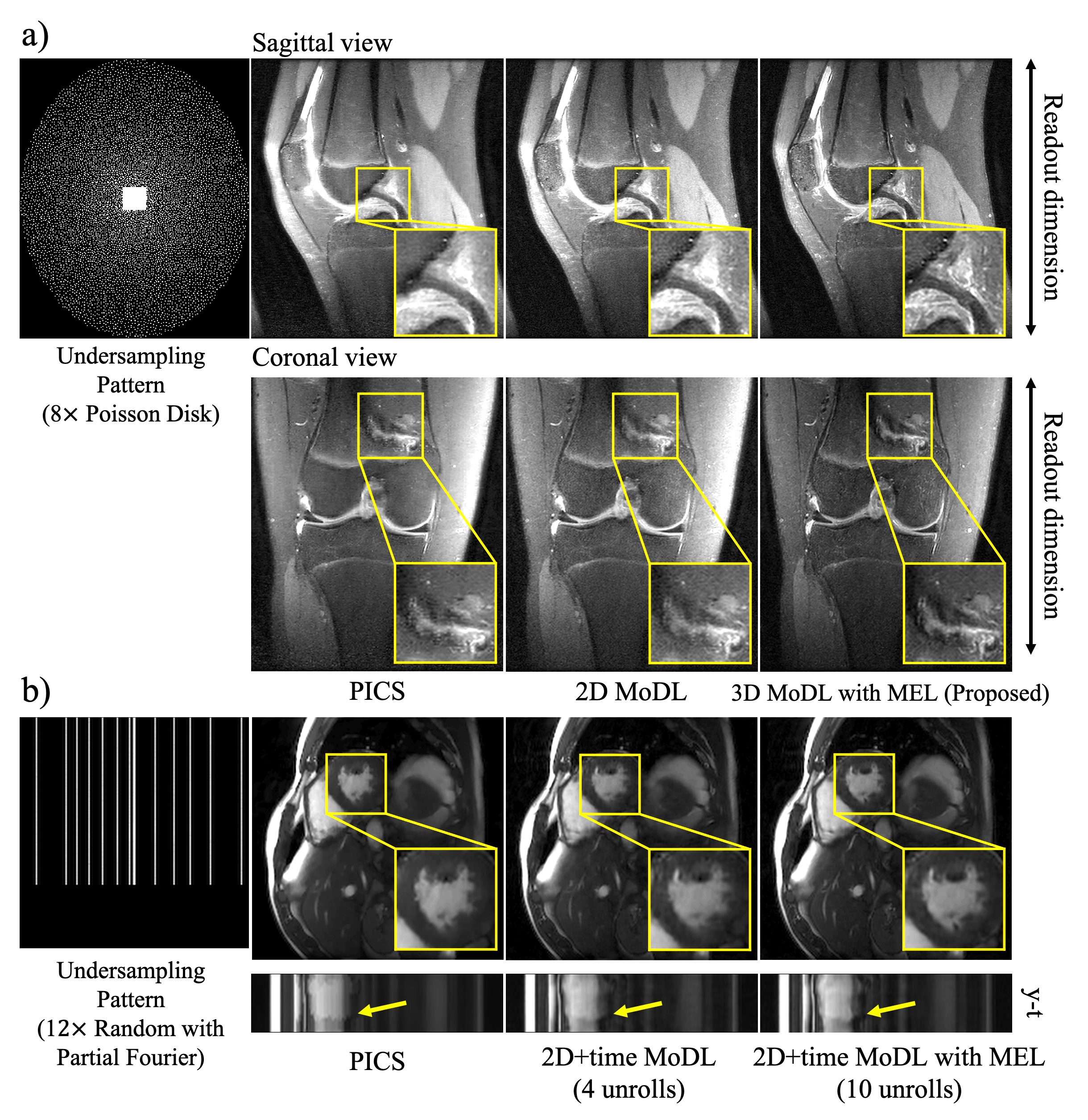 Memory-efficient Learning for High-Dimensional MRI Reconstruction | DeepAI