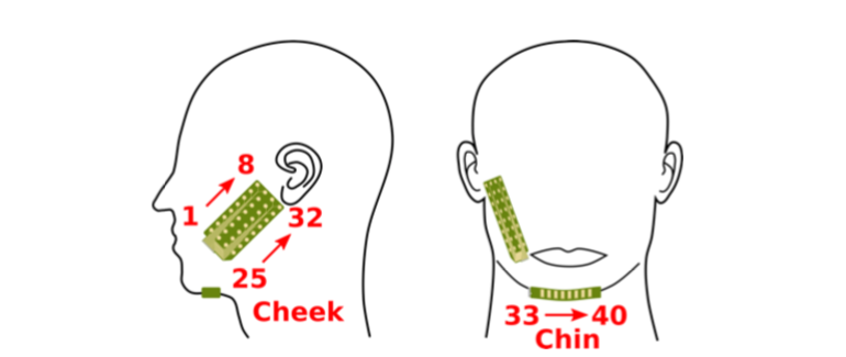 EMGSE: Acoustic/EMG Fusion for Multimodal Speech Enhancement | DeepAI