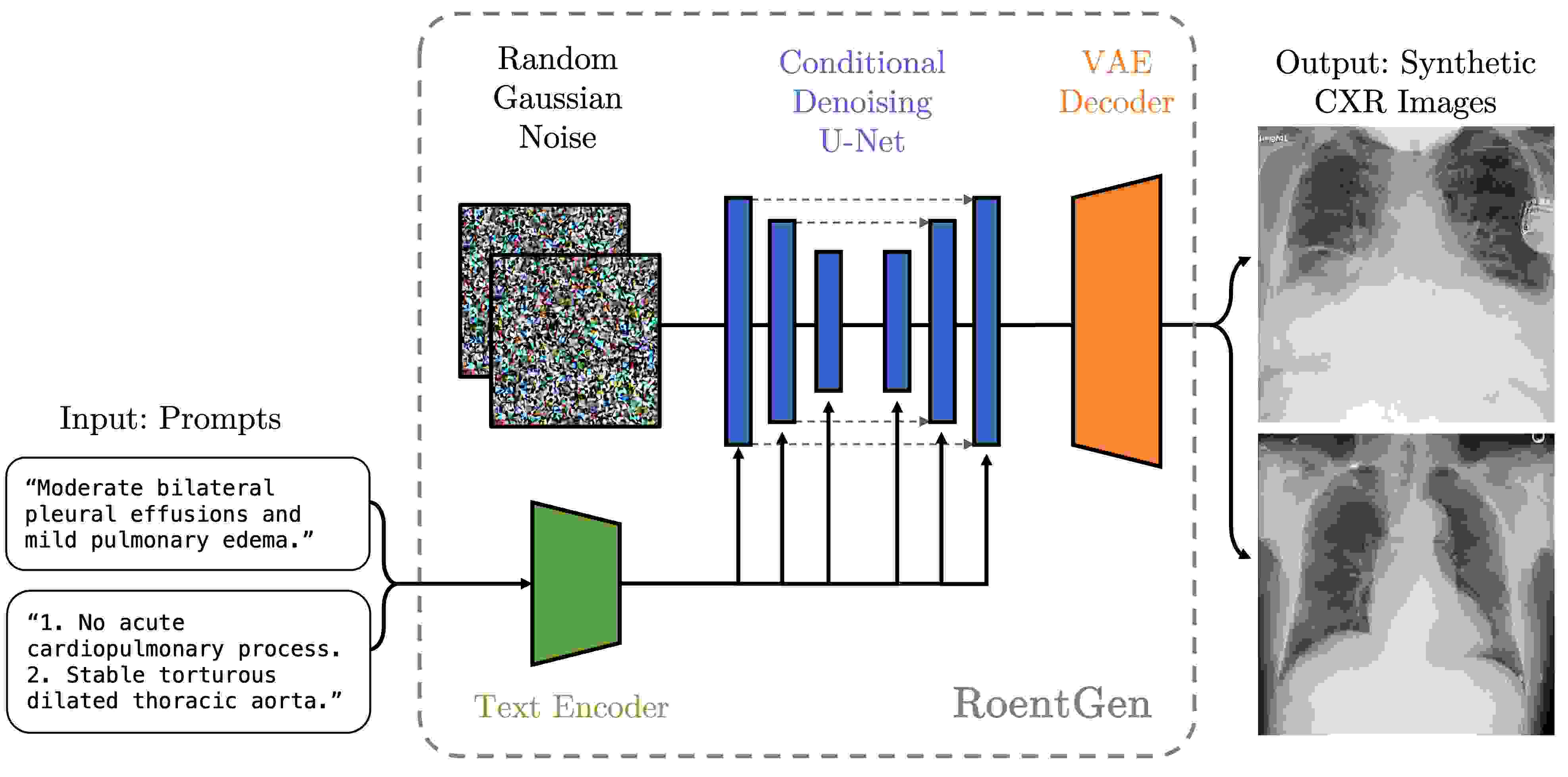 RoentGen: Vision-Language Foundation Model for Chest X-ray Generation ...