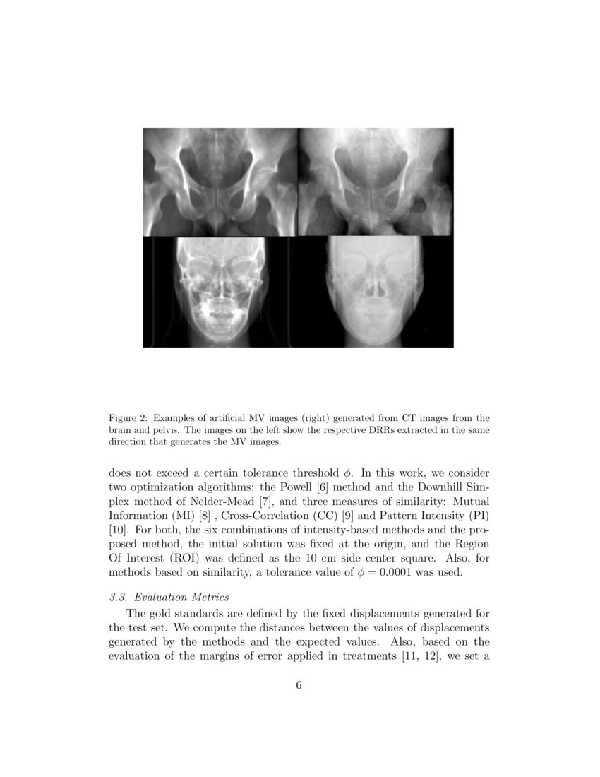 2D/3D Megavoltage Image Registration Using Convolutional Neural ...