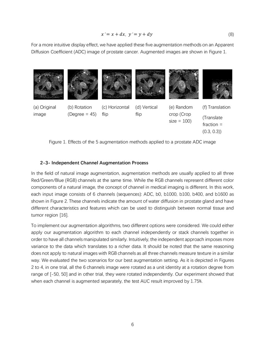 A Comprehensive Study of Data Augmentation Strategies for Prostate ...