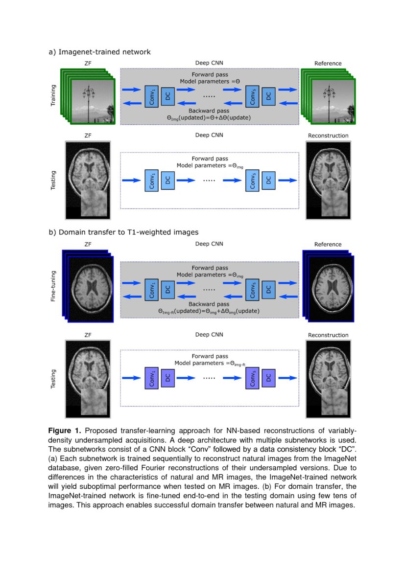 A Transfer-Learning Approach for Accelerated MRI using Deep Neural ...