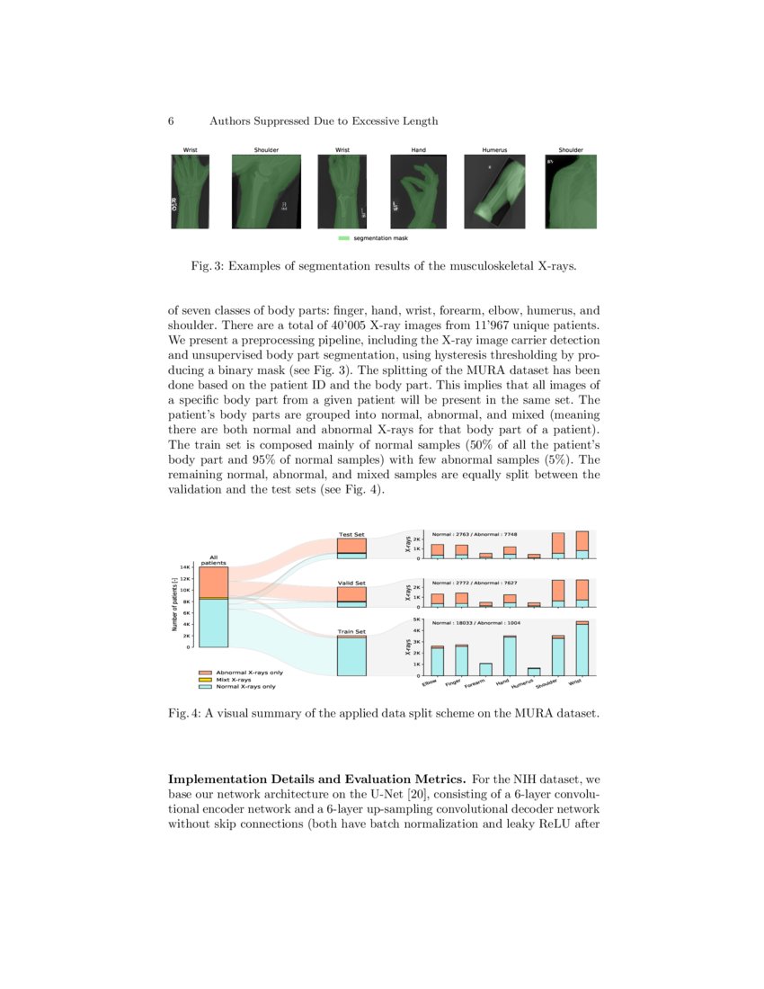 Anomaly Detection on X-Rays Using Self-Supervised Aggregation Learning ...
