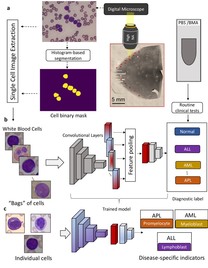 Automated Detection of Acute Promyelocytic Leukemia in Blood Films and ...