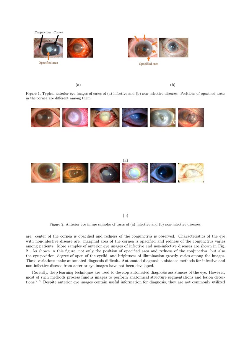 Automated eye disease classification method from anterior eye image