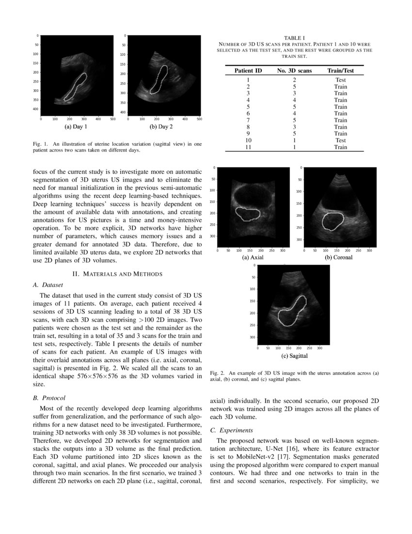 Automatic 3D Ultrasound Segmentation of Uterus Using Deep Learning | DeepAI