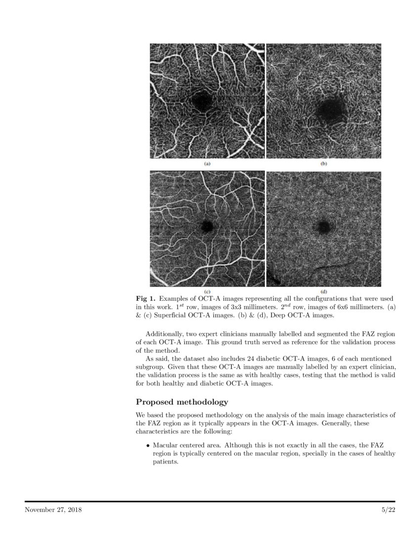 Automatic segmentation of the Foveal Avascular Zone in ophthalmological ...