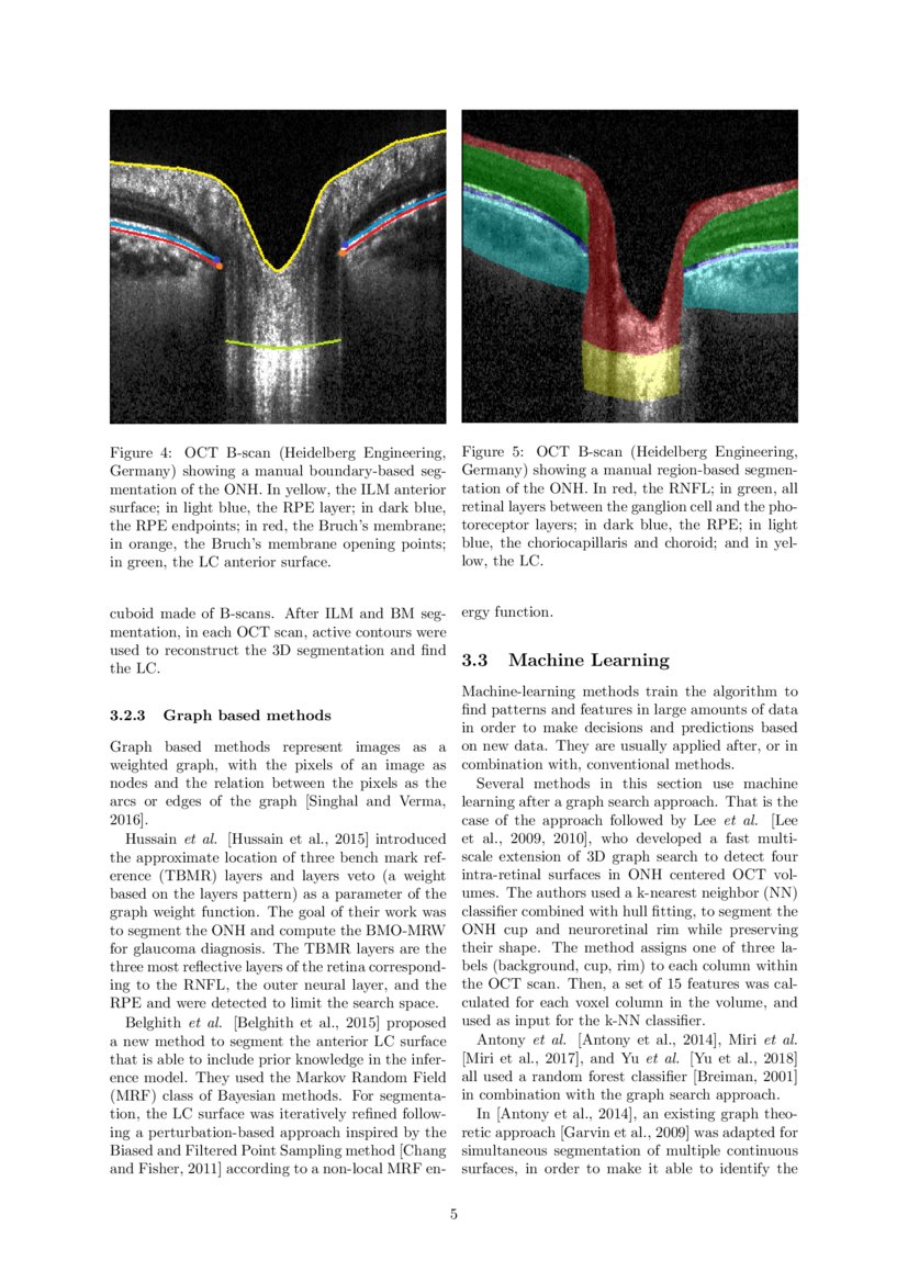 Automatic Segmentation of the Optic Nerve Head Region in Optical