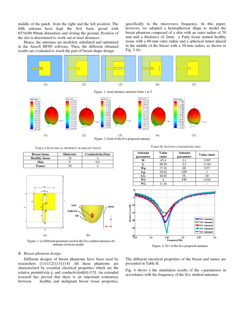 Circular Antenna Array Design for Breast Cancer Detection | DeepAI