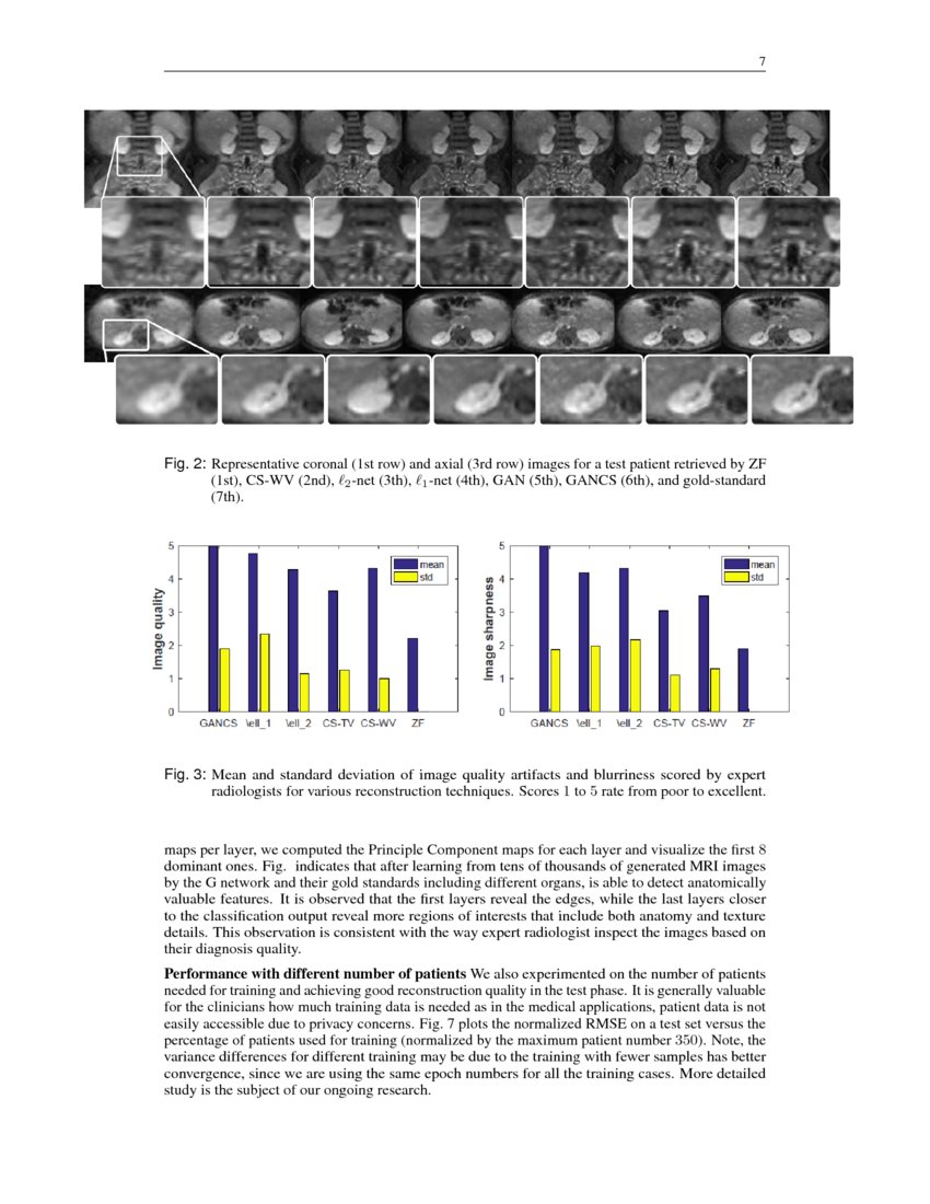 Deep Generative Adversarial Networks for Compressed Sensing Automates ...