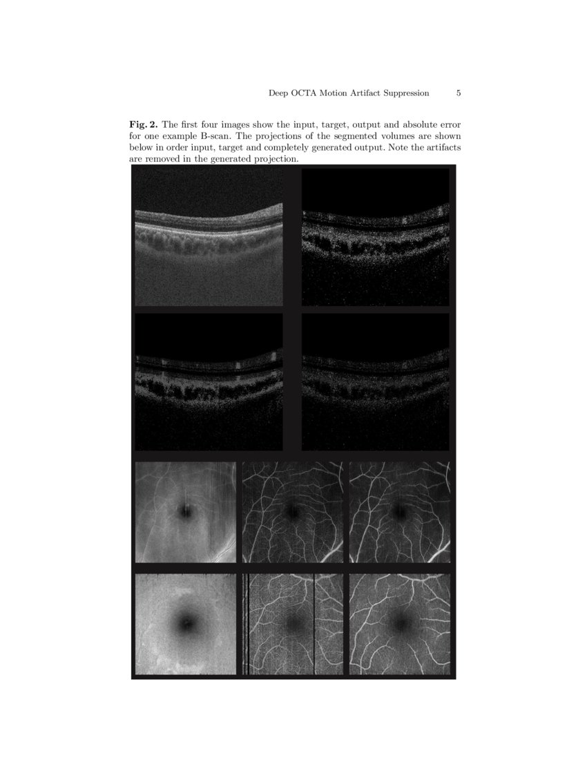 Deep OCT Angiography Image Generation for Motion Artifact Suppression