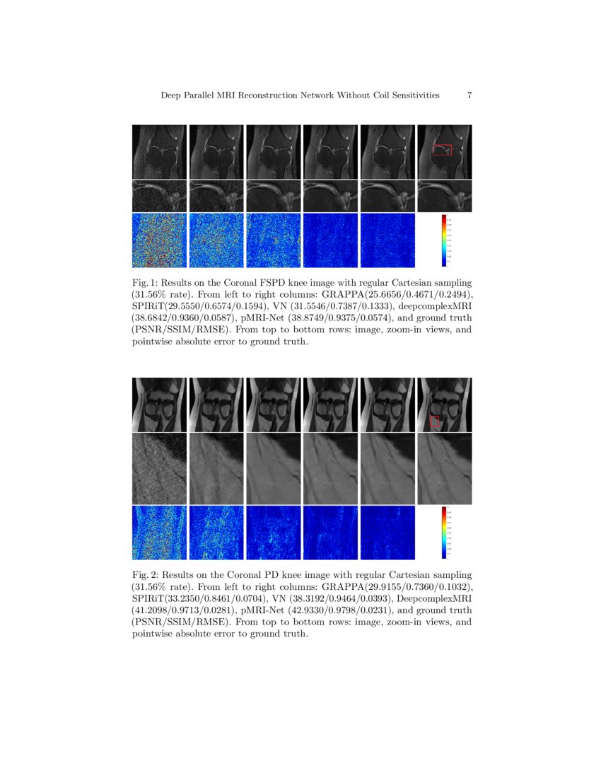 Deep Parallel MRI Reconstruction Network Without Coil Sensitivities ...