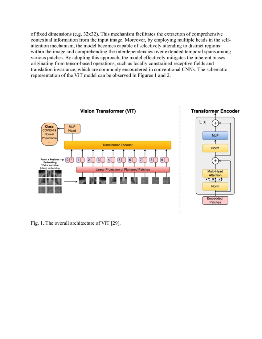 Enhancing COVID-19 Diagnosis through Vision Transformer-Based Analysis ...