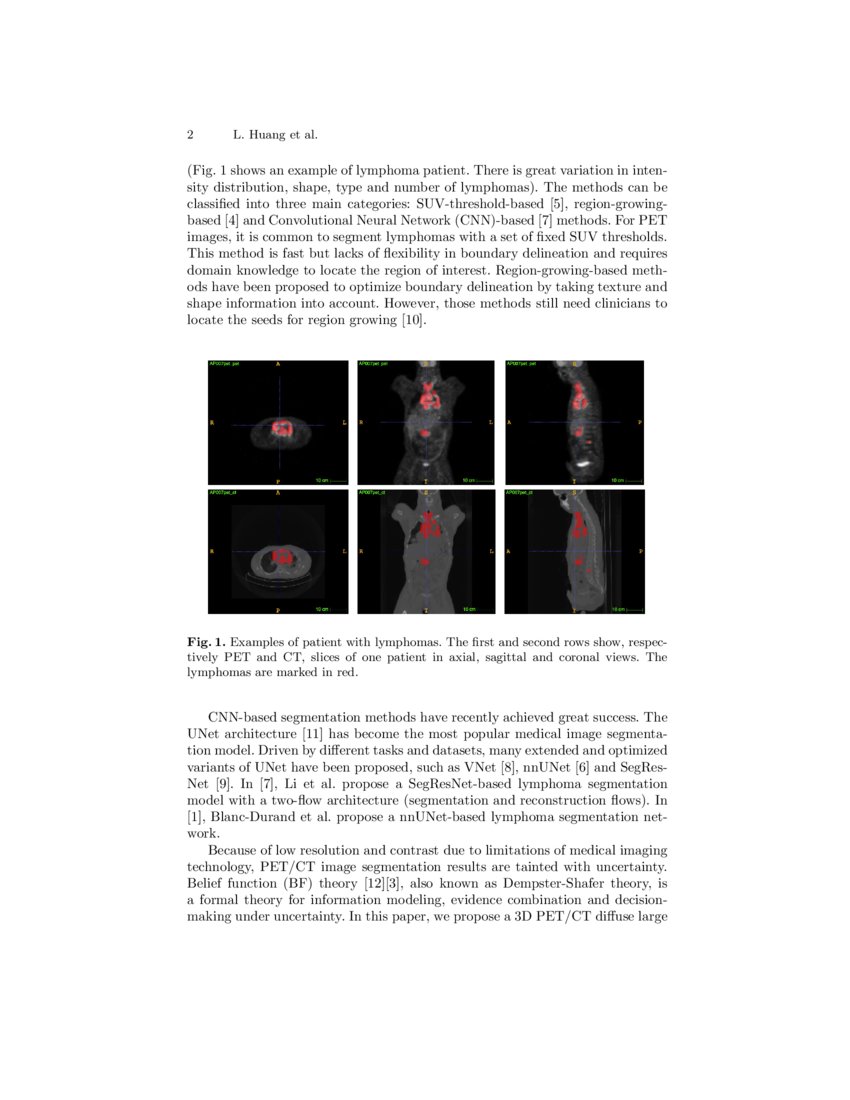 Evidential segmentation of 3D PET/CT images | DeepAI