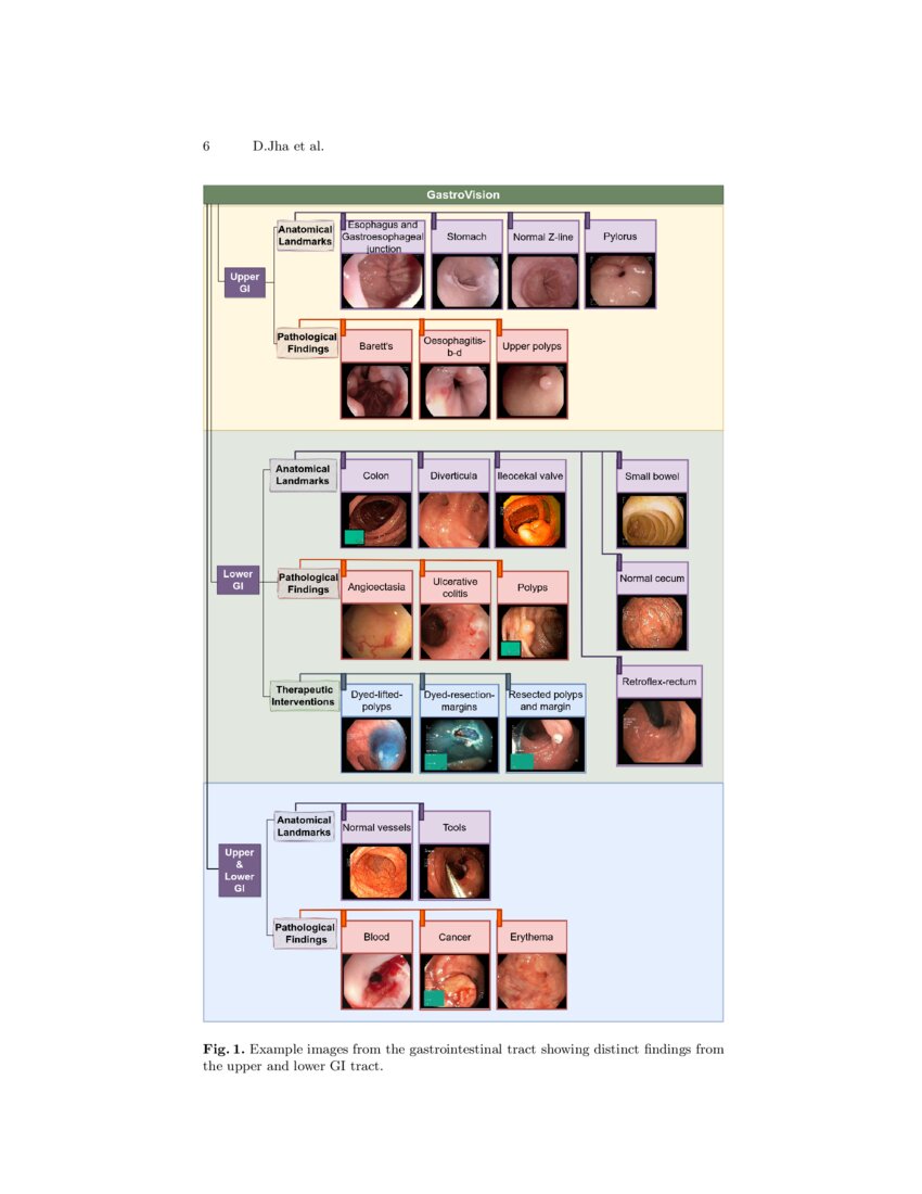 GastroVision A Multiclass Endoscopy Image Dataset for Computer Aided
