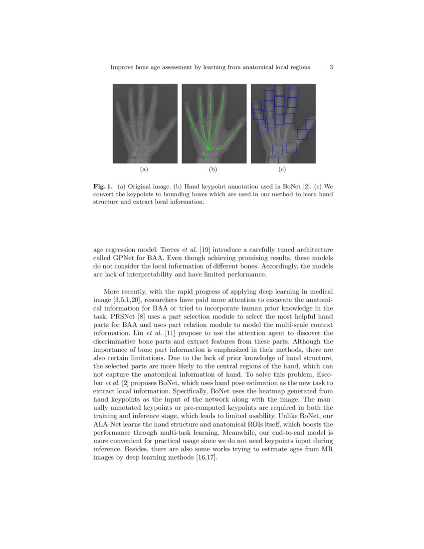 Improve bone age assessment by learning from anatomical local regions ...