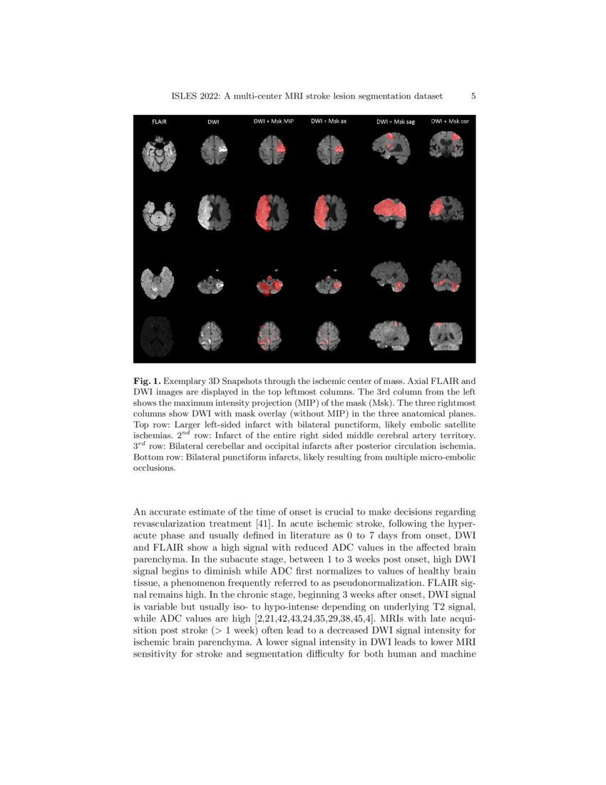 ISLES 2022 A multicenter resonance imaging stroke lesion