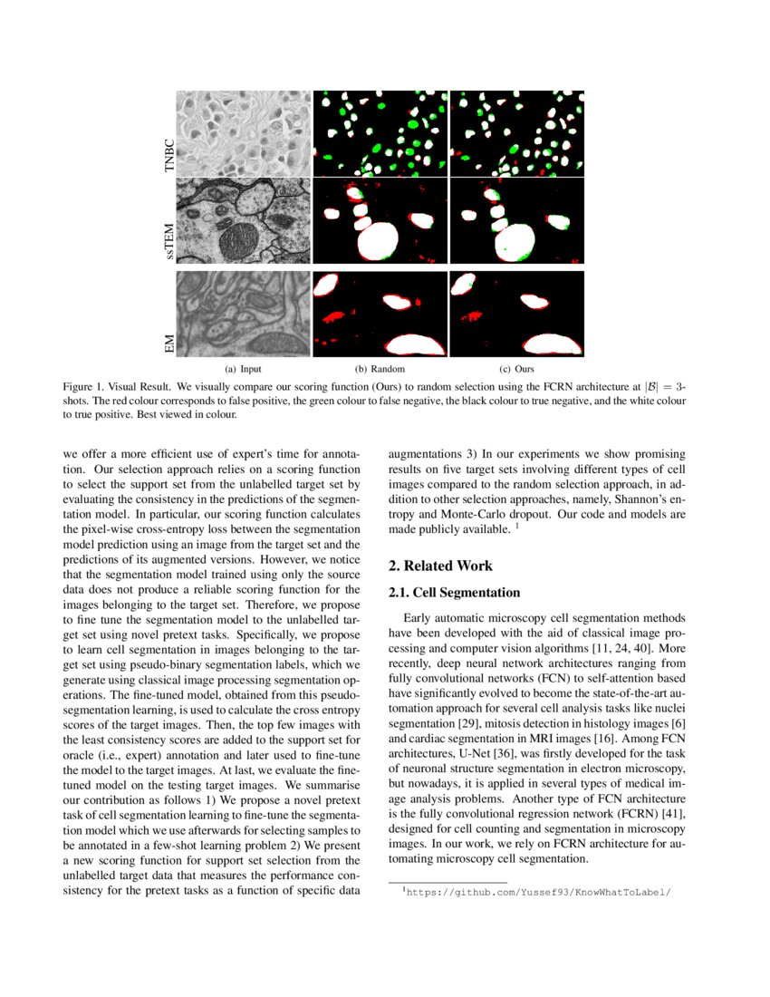 Knowing What to Label for Few Shot Microscopy Image Cell Segmentation