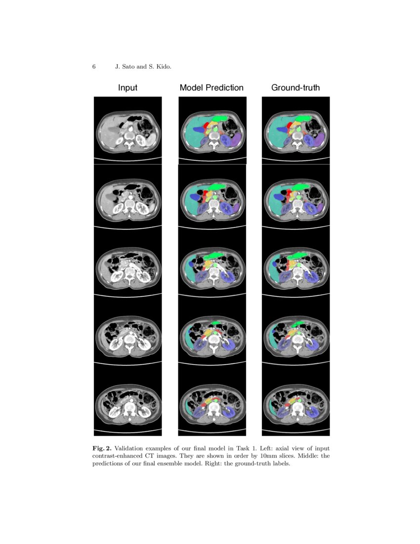 Large Batch and Patch Size Training for Medical Image Segmentation | DeepAI