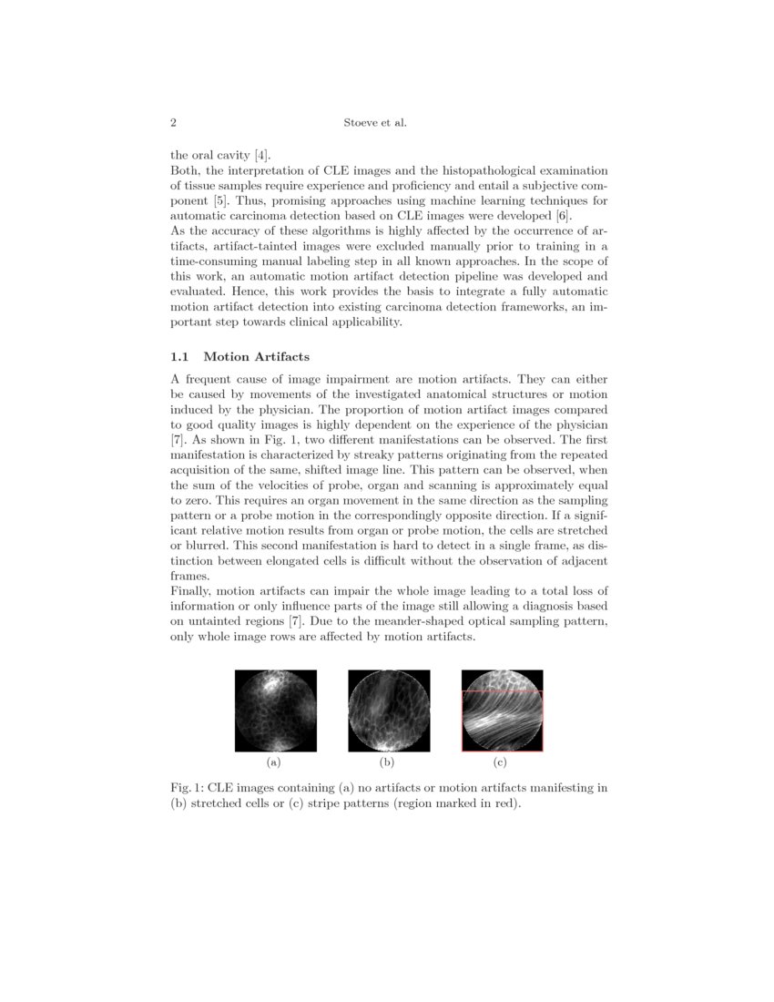 Motion Artifact Detection in Confocal Laser Endomicroscopy Images DeepAI