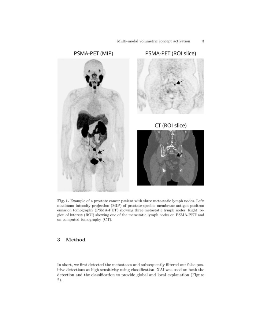Multi-modal volumetric concept activation to explain detection and ...