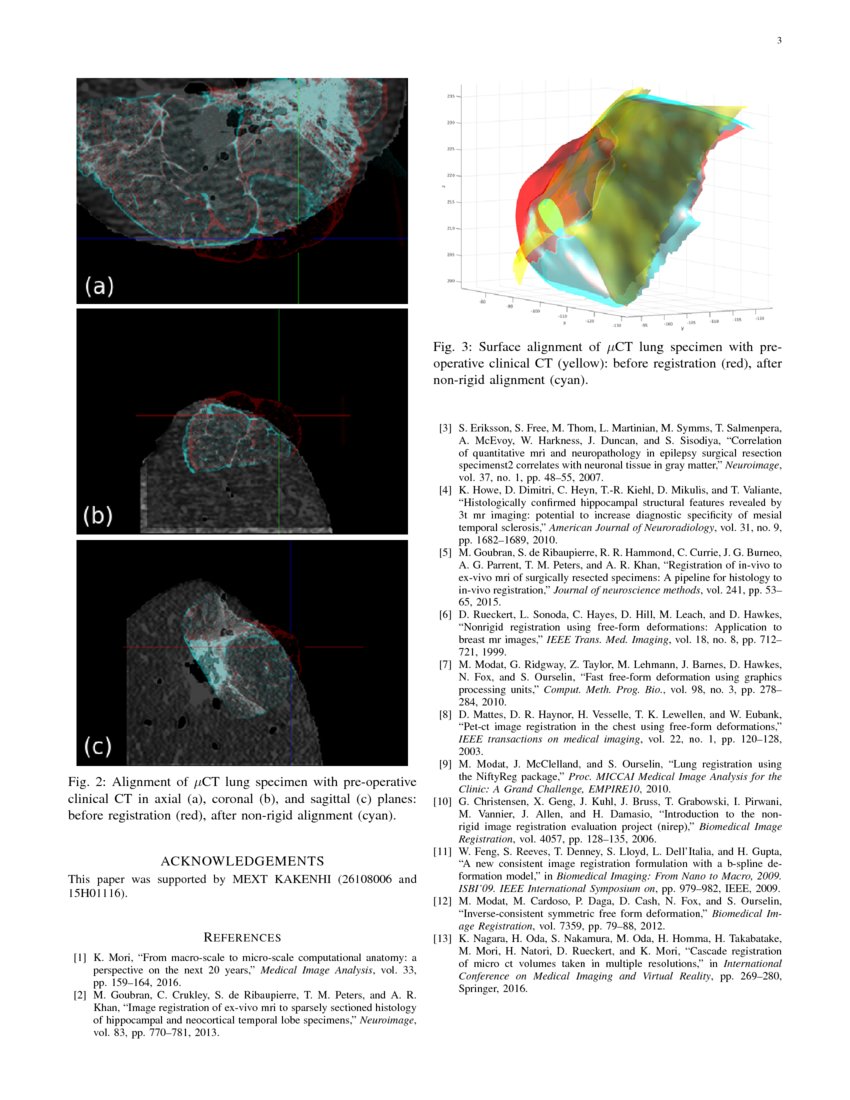 Multi-scale Image Fusion Between Pre-operative Clinical CT and X-ray ...