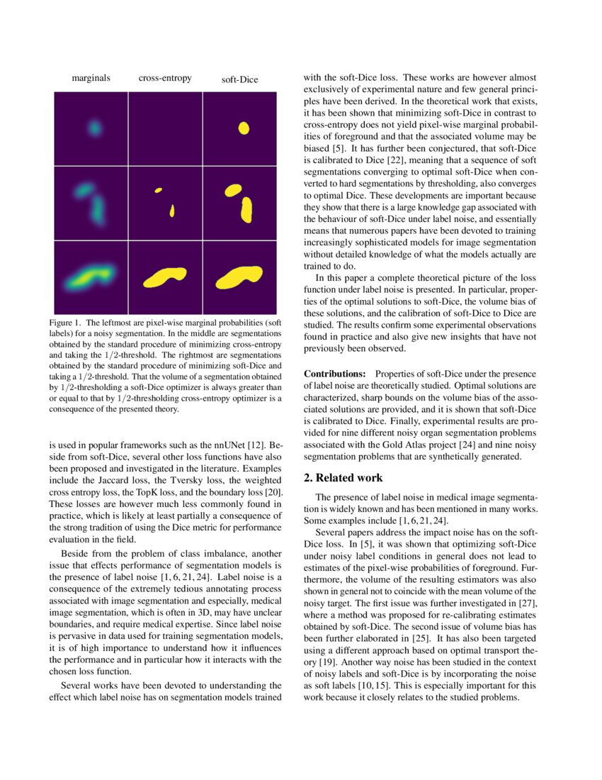 Noisy Image Segmentation With SoftDice DeepAI