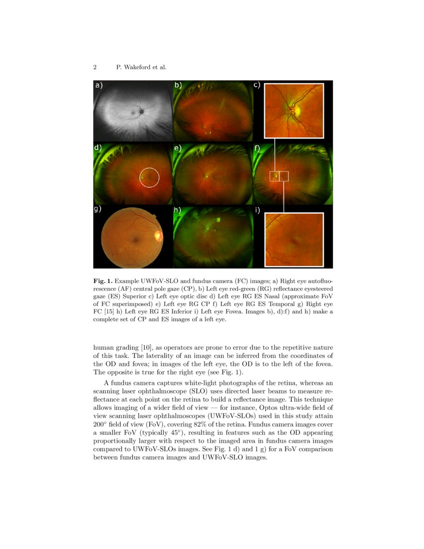Optic disc and fovea localisation in ultrawidefield scanning laser