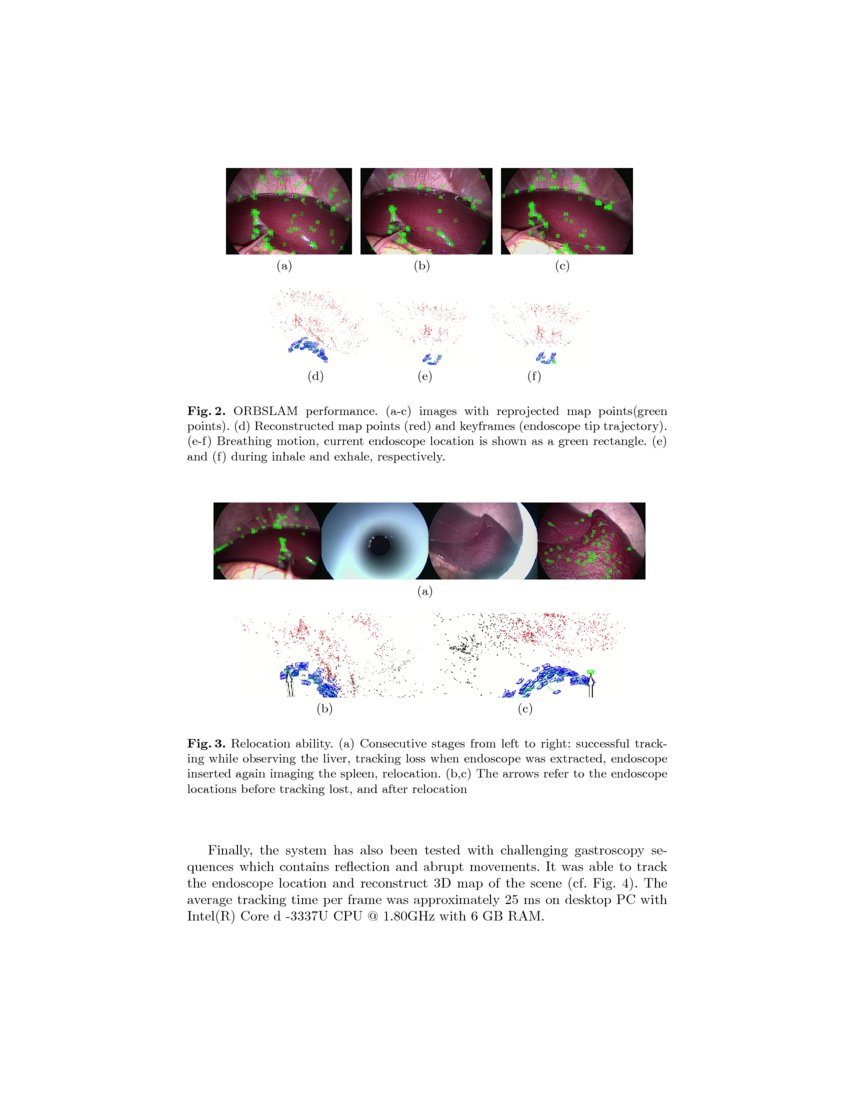 ORBSLAMbased Endoscope Tracking and 3D Reconstruction DeepAI