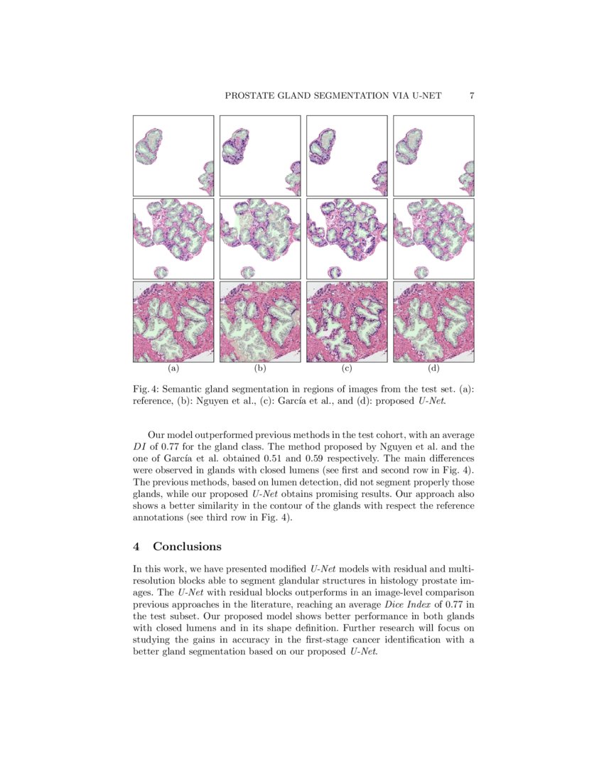 Prostate gland segmentation in histology images via residual and multi