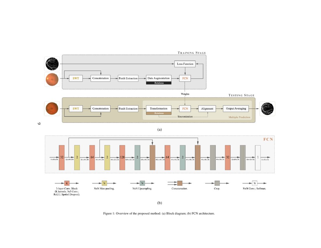 Retinal Vessel Segmentation Based On Fully Convolutional Neural Retinal Vessel Segmentation Based On Fully Convolutional Neural