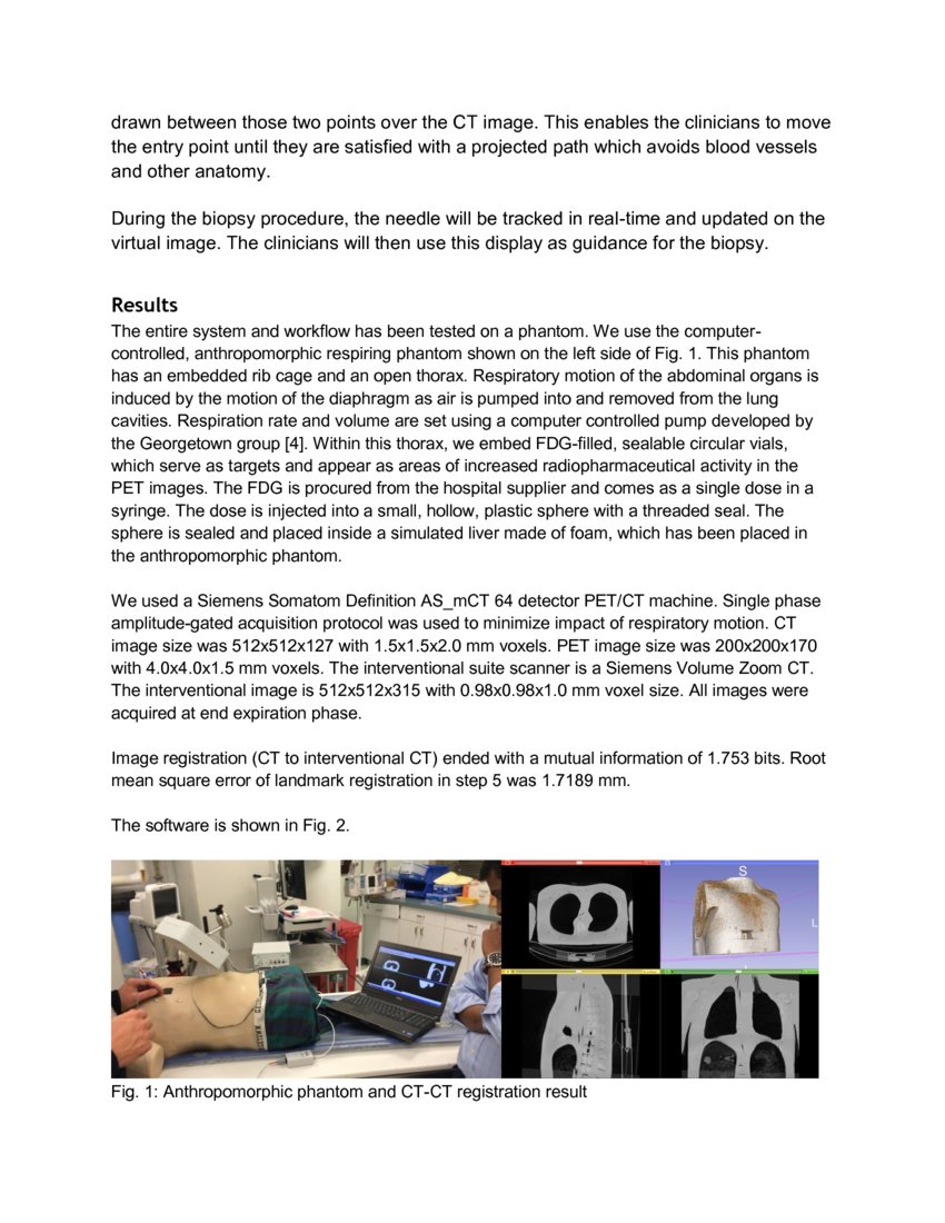 SlicerPET: A workflow based software module for PET/CT guided needle ...