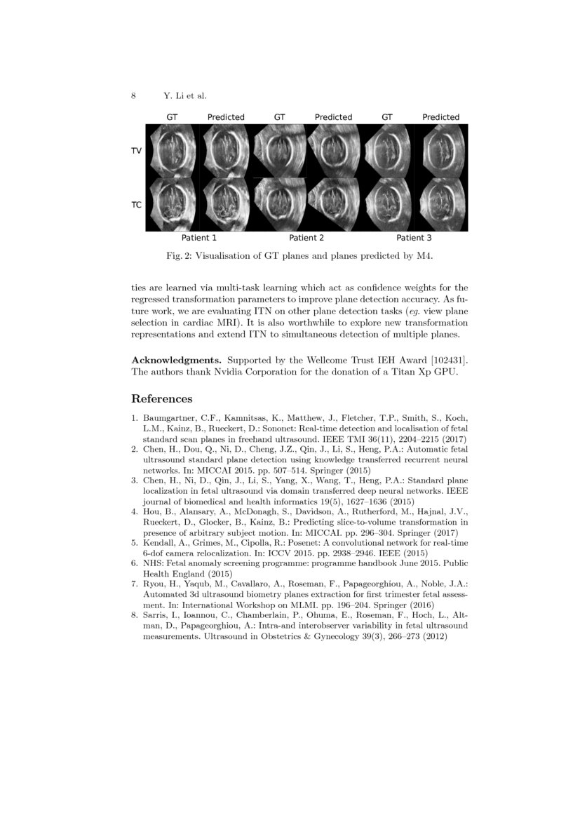 Standard Plane Detection in 3D Fetal Ultrasound Using an Iterative ...