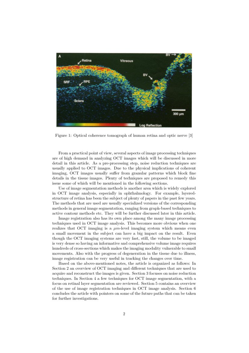 State-of-the-Art in Retinal Optical Coherence Tomography Image Analysis ...