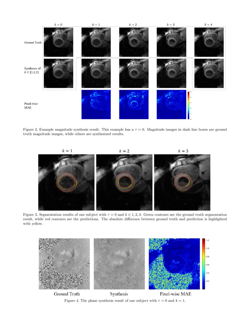 Synthetic Velocity Mapping Cardiac MRI Coupled with Automated Left Ventricle Segmentation DeepAI
