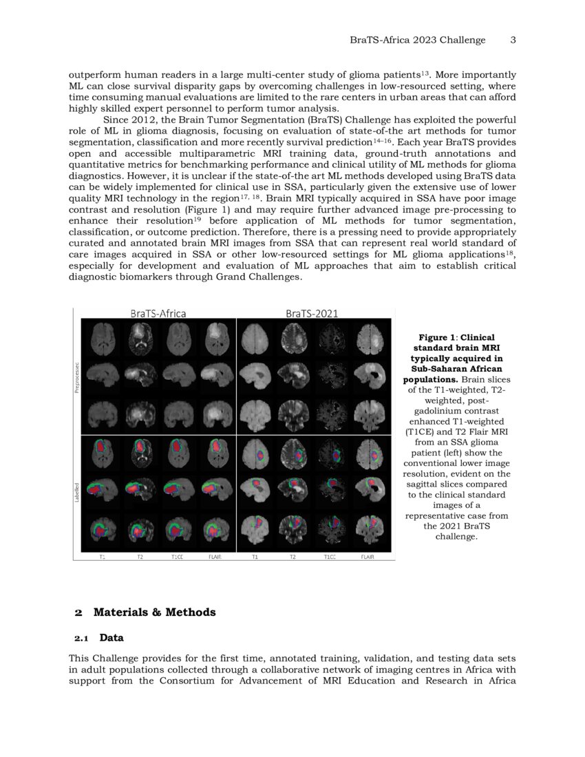 The Brain Tumor Segmentation (BraTS) Challenge 2023: Glioma ...