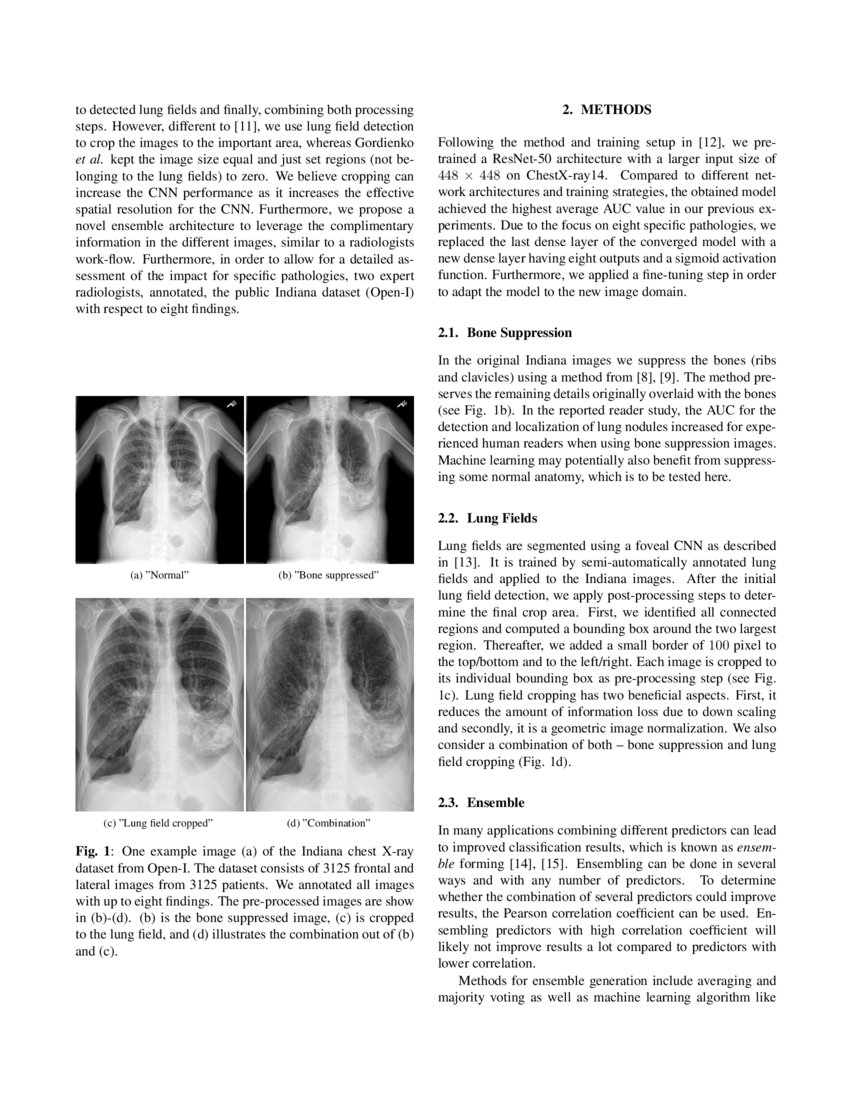When does Bone Suppression and Lung Field Segmentation Improve Chest X