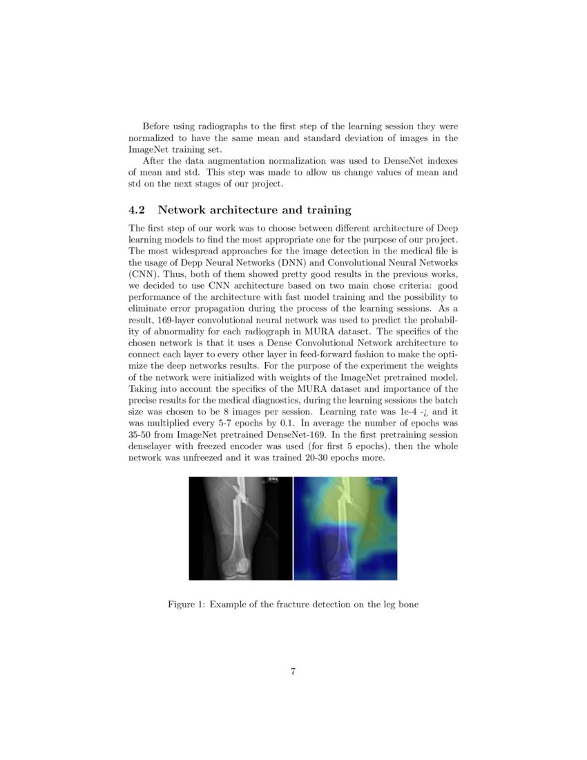 X-Ray bone abnormalities detection using MURA dataset | DeepAI